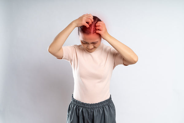 Why is your scalp burning?