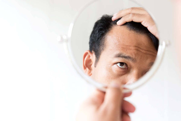 Hair Loss: Causes & Prevention